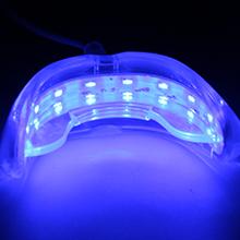 Load image into Gallery viewer, bangkok teeth whitening